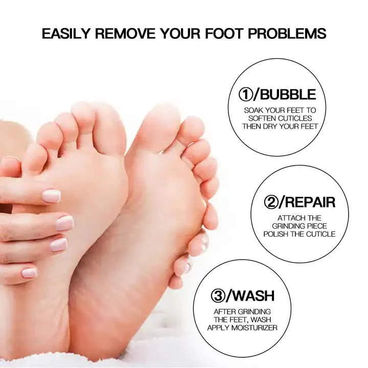 Silver Electric Foot Callus Remover - Portable Pedicure