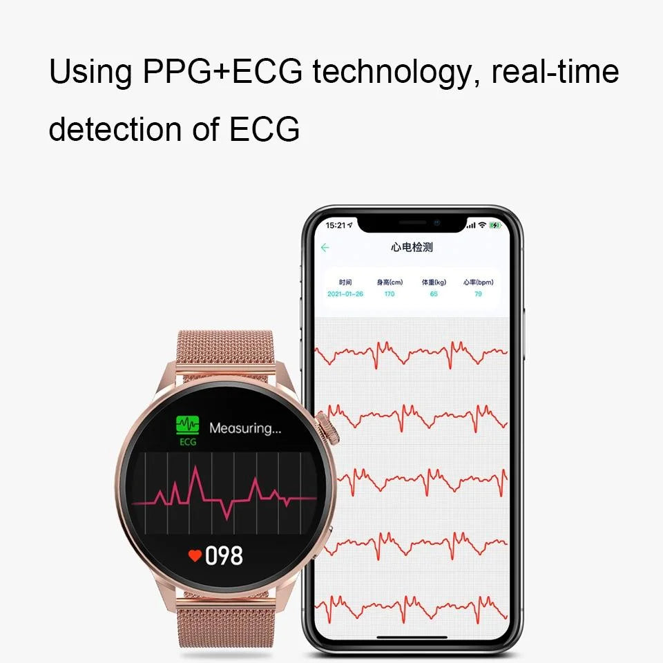 1.36 Inch Hd Screen Smart Call Watch With Nfc Function