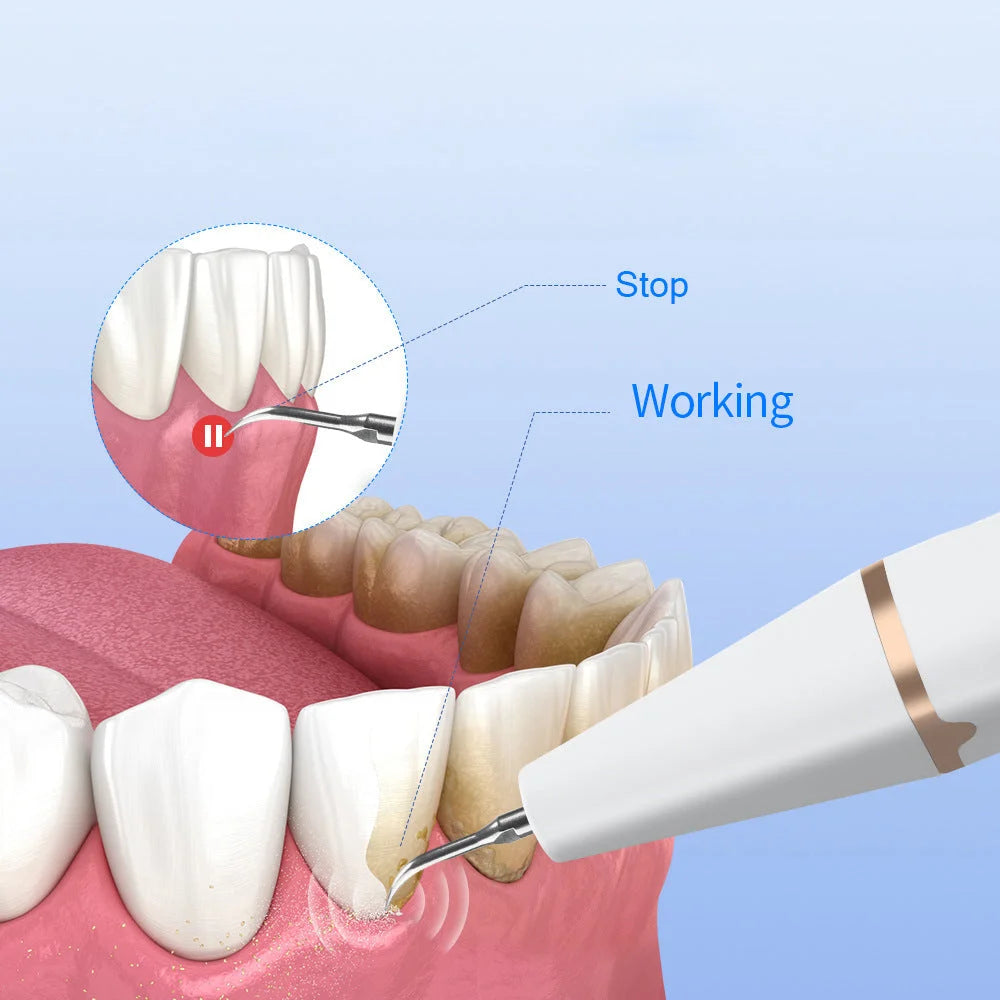 3-Speed Ultrasonic Electric Dental Cleaner with LED Light