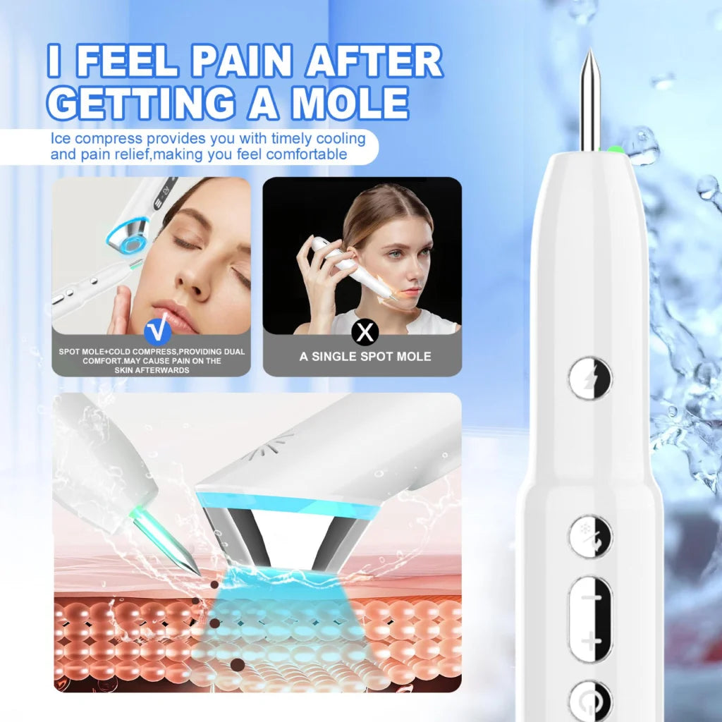 Advanced 3-in-1 Skin Care Device: 15-Level Spot Remover Pen