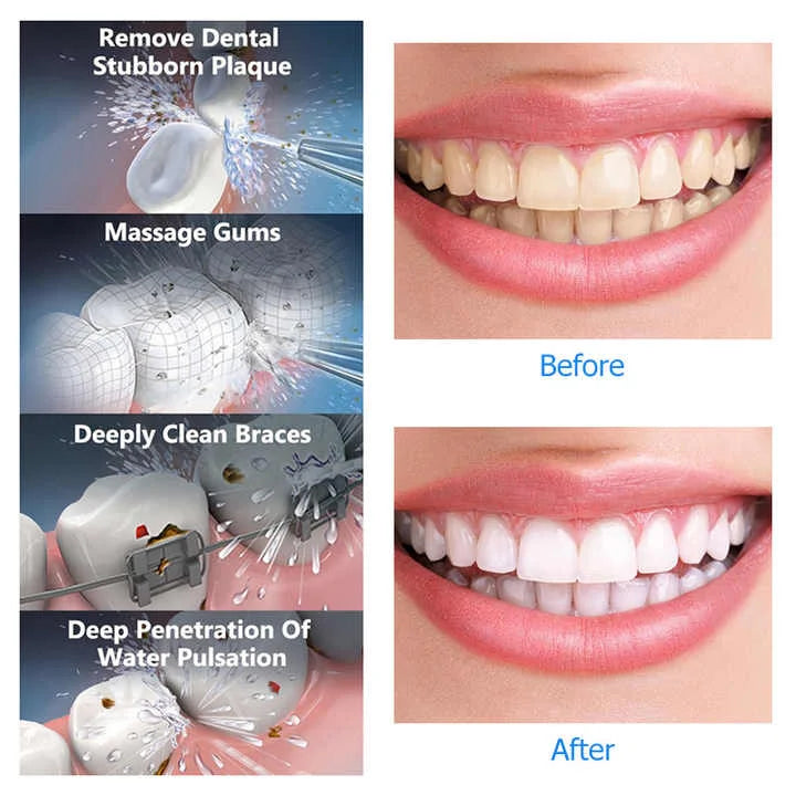 Black Advanced Portable Water Flosser - Rechargeable Oral