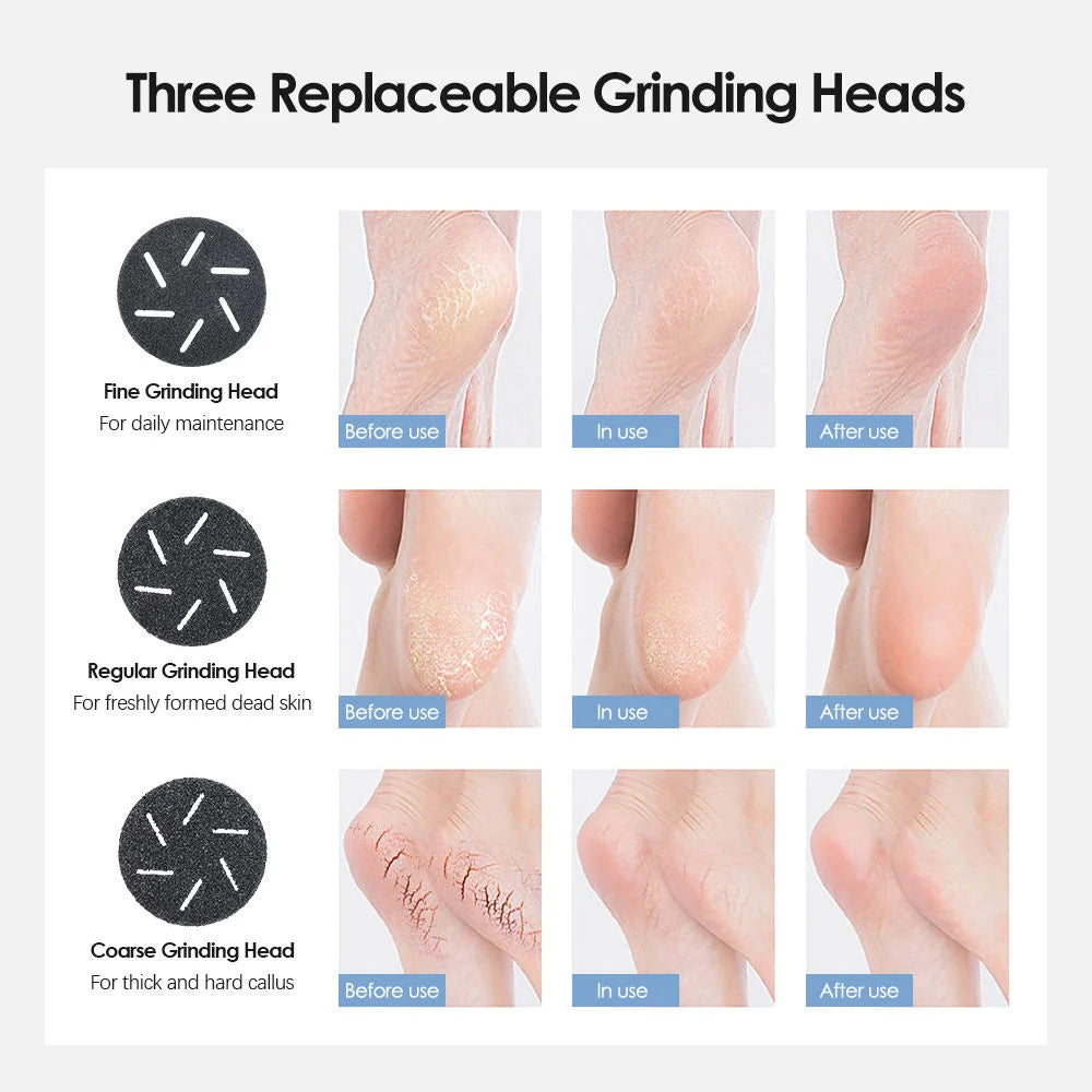 Black Rechargeable Electric Foot Grinder with Suction