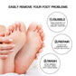 Gray Electric Foot Callus Remover - Portable Pedicure Tool