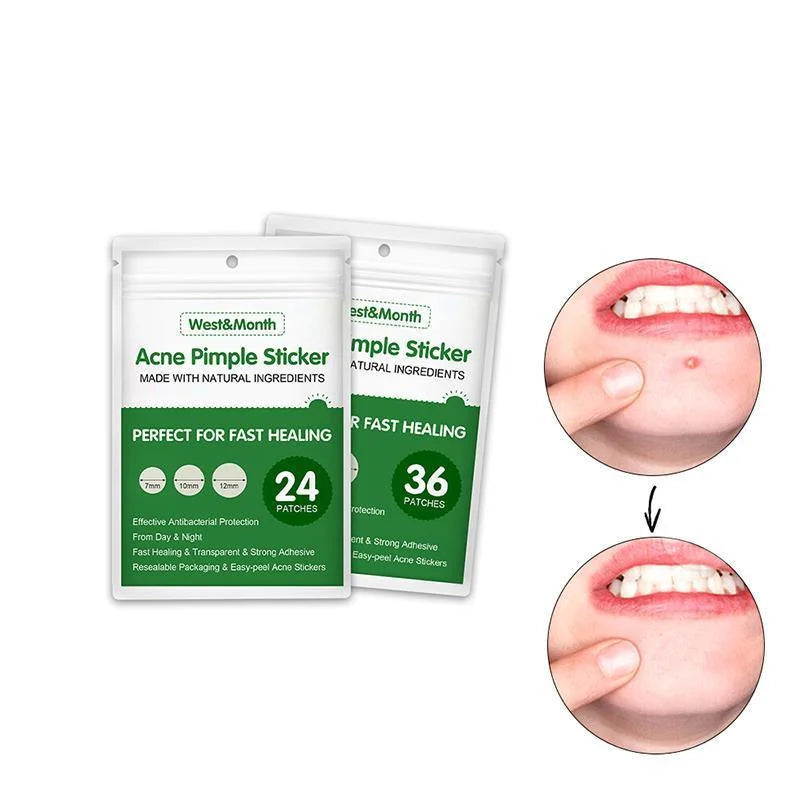 Skin Tag Remover Acne Pimple Patch Removal Facial Care Spot