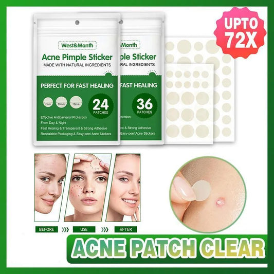 Skin Tag Remover Acne Pimple Patch Removal Facial Care Spot