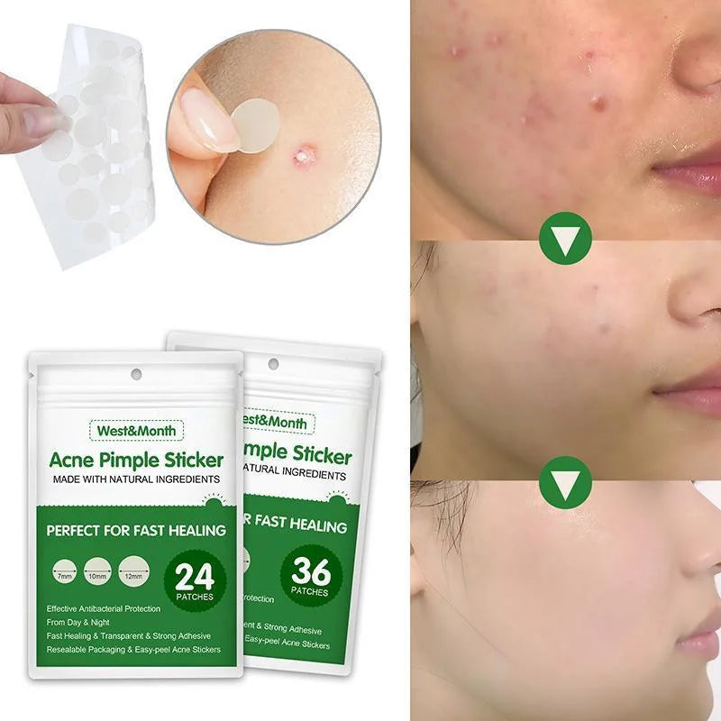 Skin Tag Remover Acne Pimple Patch Removal Facial Care Spot