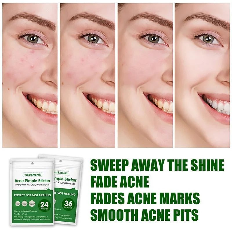 Skin Tag Remover Acne Pimple Patch Removal Facial Care Spot