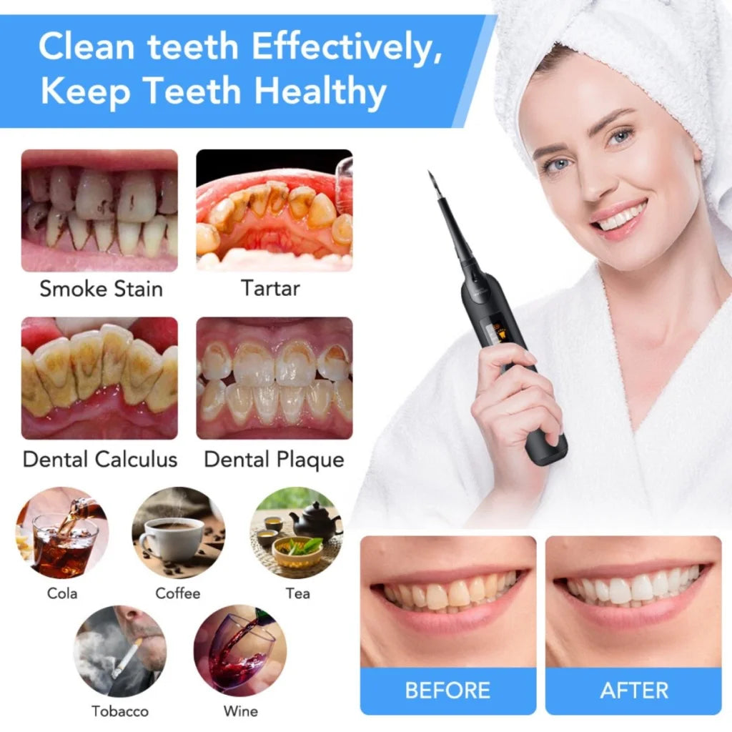 Ultrasonic Dental Tartar Plaque Calculus Tooth Remover Set