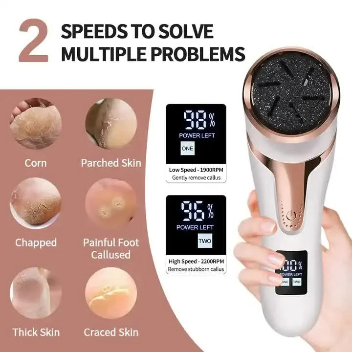 White Electric Foot Callus Remover - Rechargeable