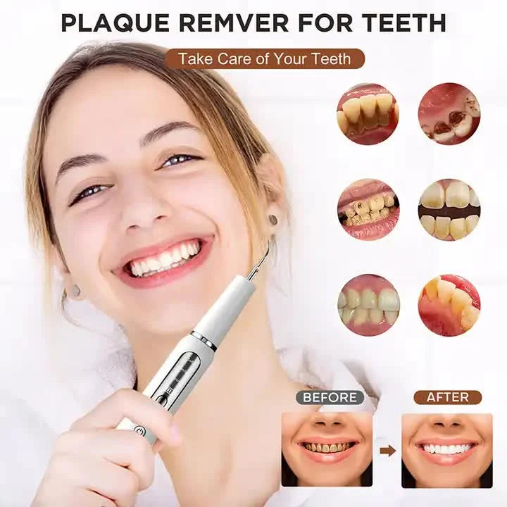 White Portable Ultrasonic Dental Cleaner Home Use Plaque