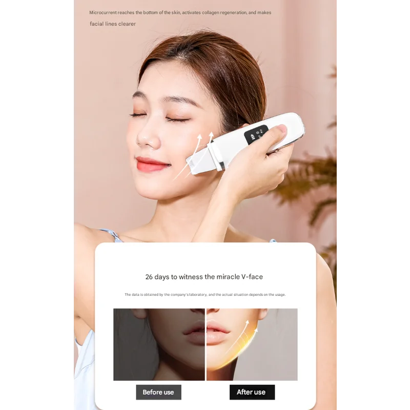 White Professional 4-in-1 Ultrasonic Skin Scrubber - Deep