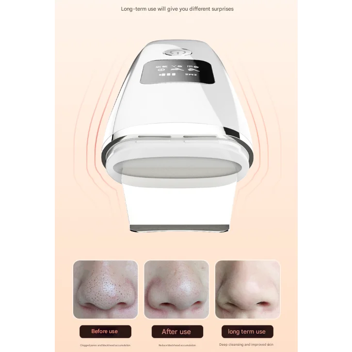 White Professional 4-in-1 Ultrasonic Skin Scrubber - Deep